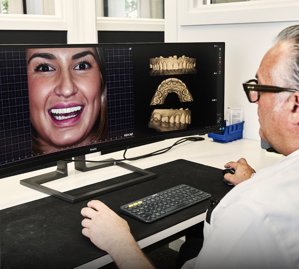 The Mock-Up Reveal: Why You Should See Your New Smile Before Any Treatment Begins 4 Digital Design