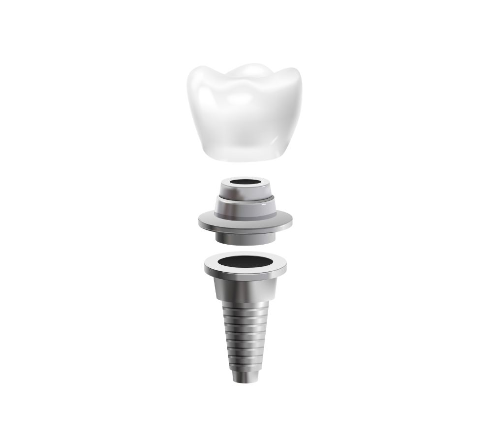 Dental Implant Costs in Melbourne: What You’ll Actually Pay in 2026