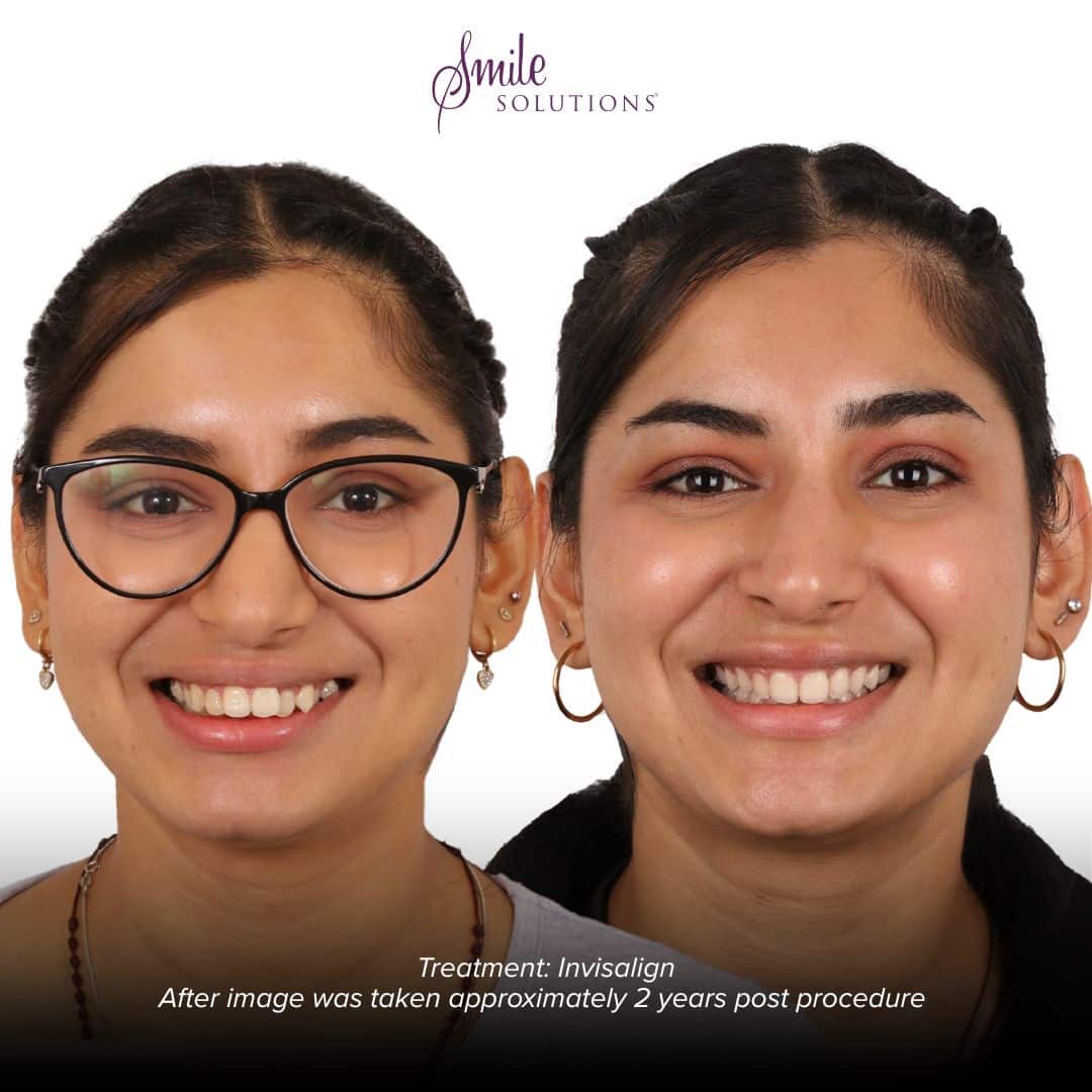 Complimentary Orthodontic Consultation 7 Smile I 3