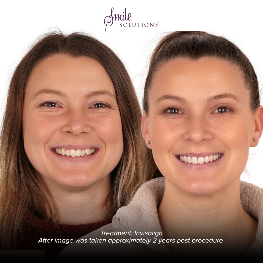 Complimentary Orthodontic Consultation 3 Smile I
